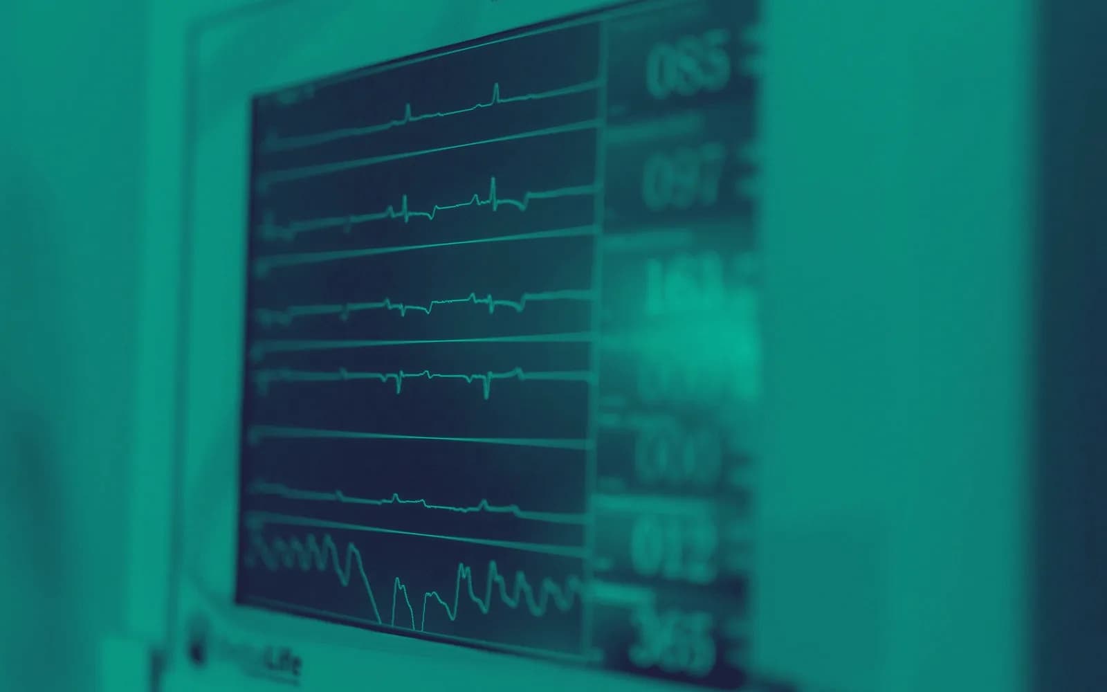 Hospital vital signs monitor displaying ECG traces and numeric readouts in an ICU setting